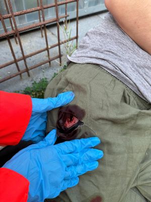 Wound moulage stab groin, Wound Packing