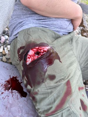 Wound Moulage Shot Groin, Wound Packing