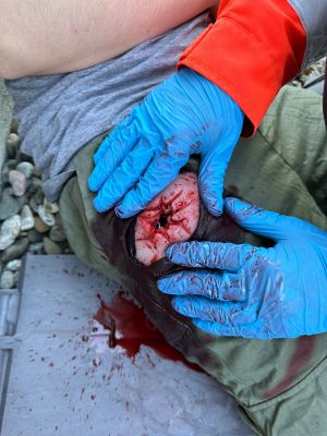 Wound Moulage Shot Groin, Wound Packing