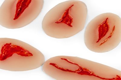 Wound Moulages - Set Standard