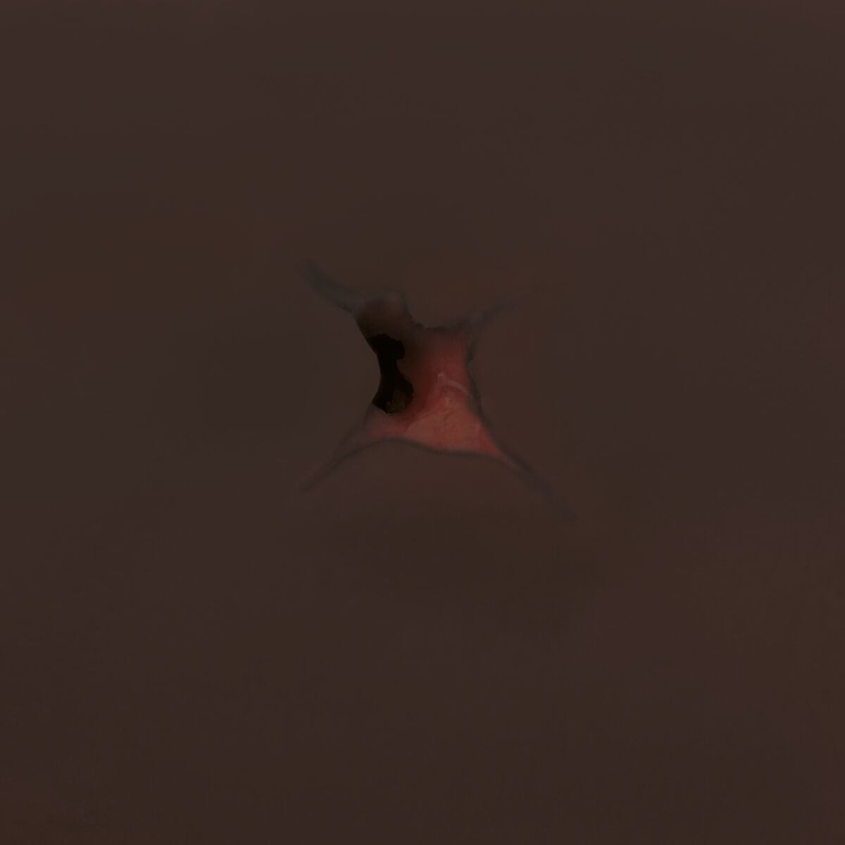 Hemorrhage Control Arm Trainer, Dark Skin