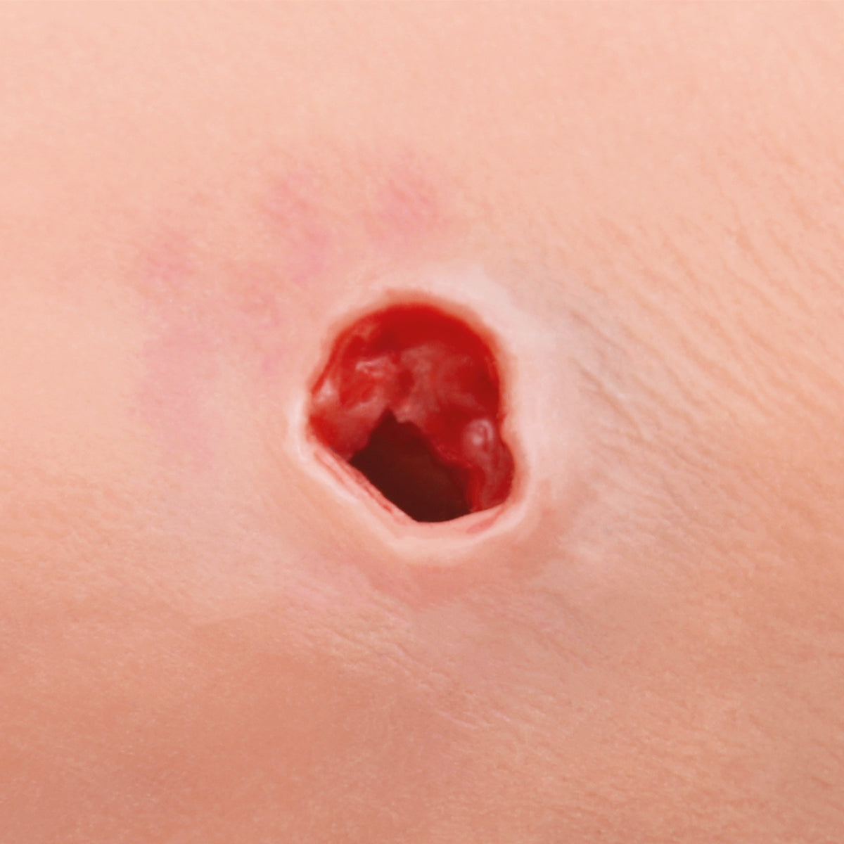 Hemorrhage Control Arm Trainer, Light Skin