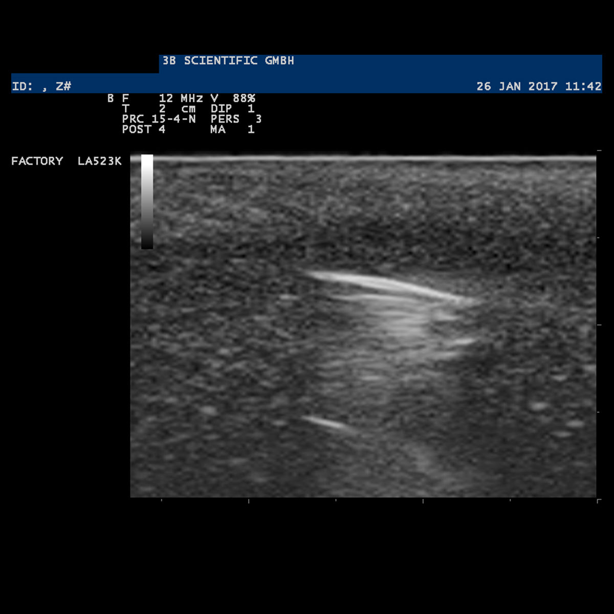 SONOtrain Foreign Body Model, Light Skin