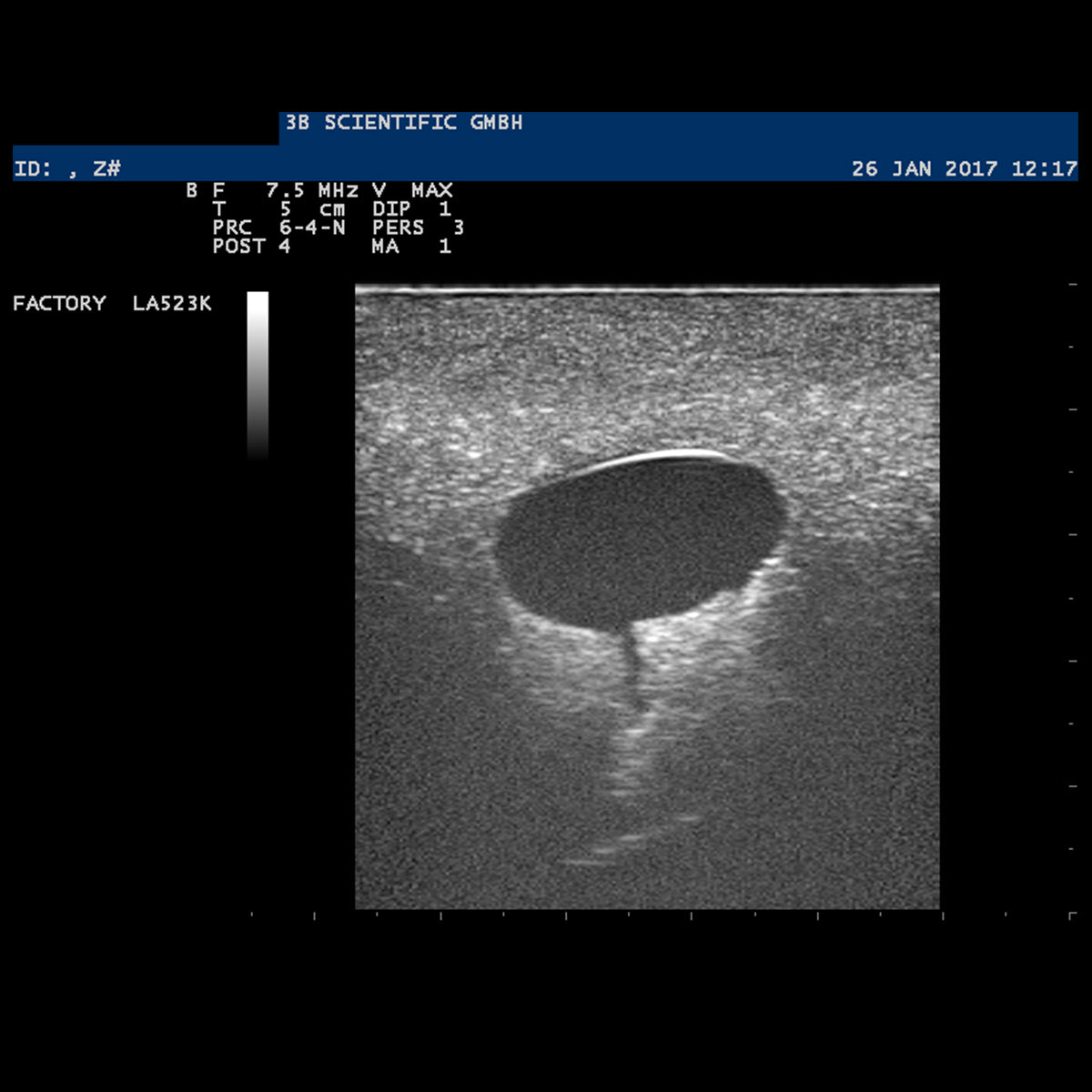 SONOtrain Breast Model with Cysts