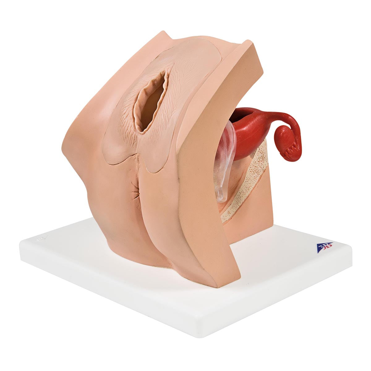 Model for Gynecological Patient Education
