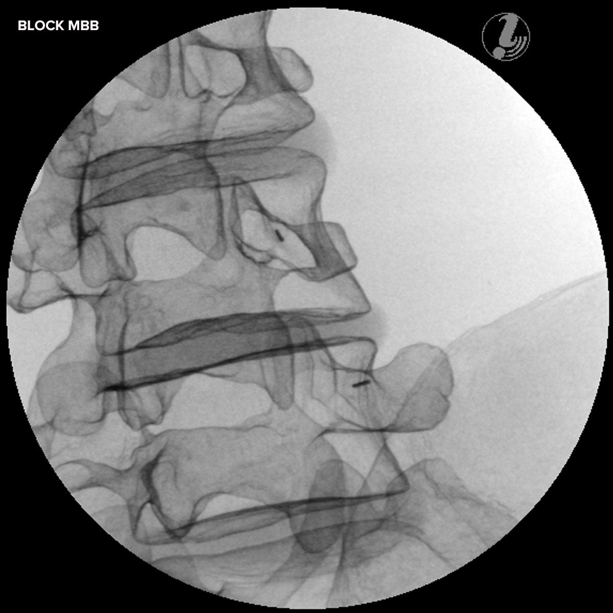 Image Guided Lumbar Spinal Injection Trainer P65