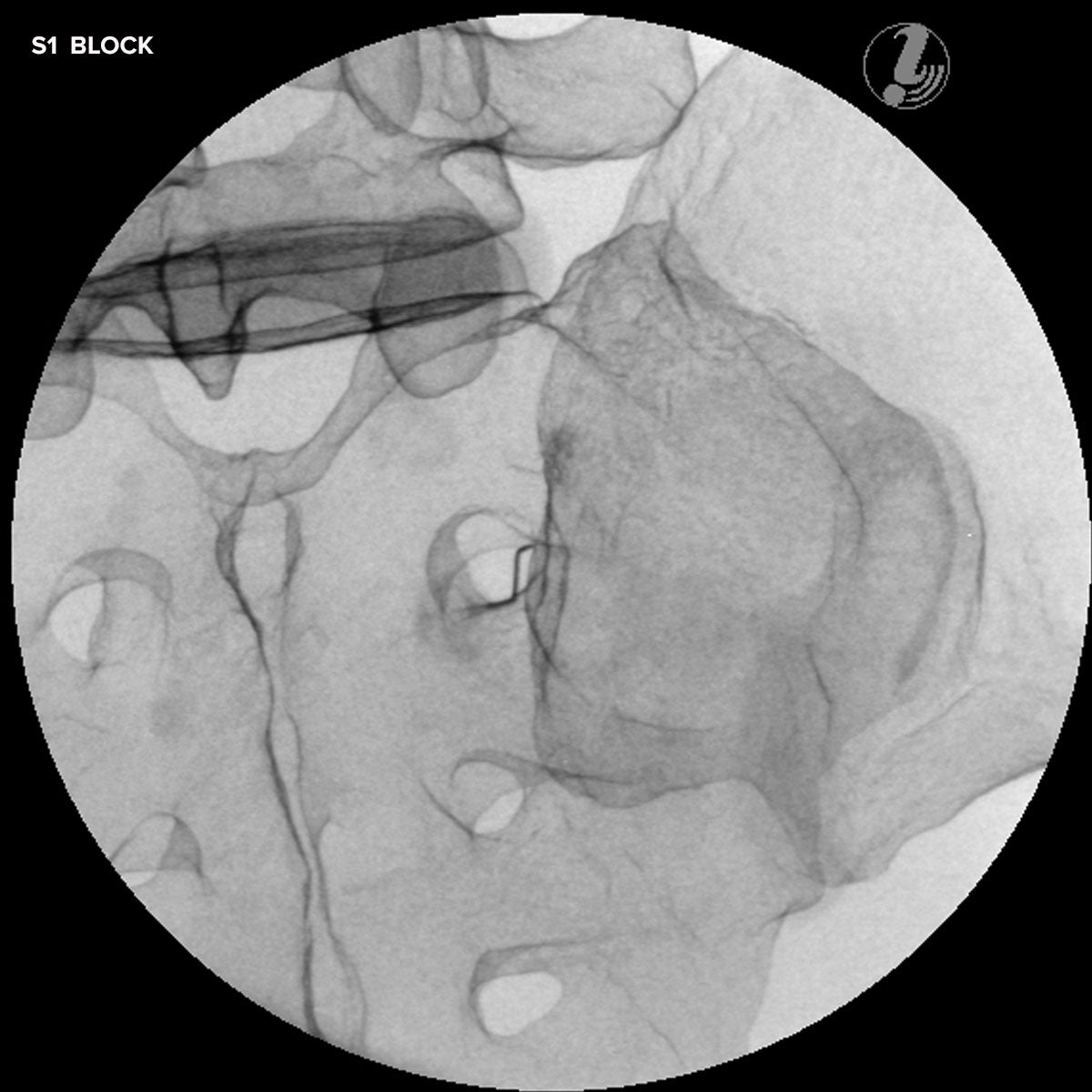 Image Guided Lumbar Spinal Injection Trainer P65