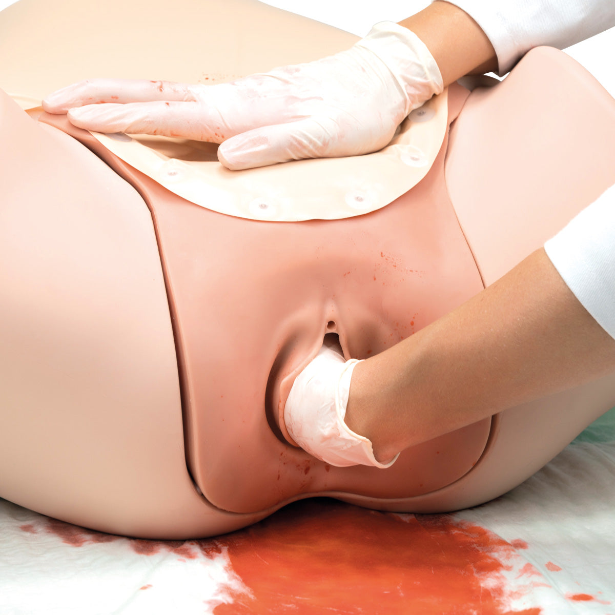 Postpartum Hemorrhage Trainer - PPH Trainer P97