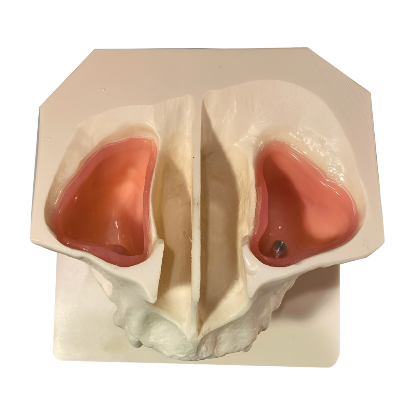 PM-200 – Sinus Lift
