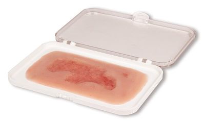 Wound moulage venous leg ulcer, small, epithelization phase