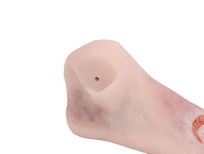 Wound foot with diabetic foot syndrome, manikin version - Erler-Zimmer PW006P, view 3