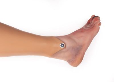 Wound foot with diabetic foot syndrome, manikin version - Erler-Zimmer PW006P, view 2