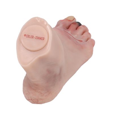 Wound foot with diabetic foot syndrome - Erler-Zimmer PW006, view 2
