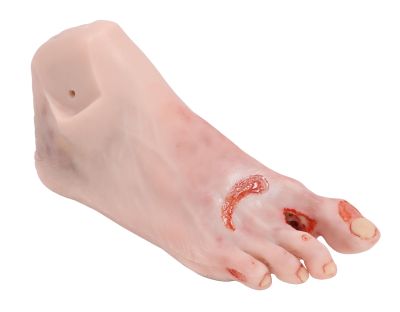 Wound foot with diabetic foot syndrome, severe stage, manikin version - Erler-Zimmer PW007P