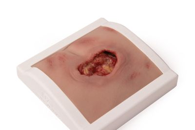 Wound moulage sacral decubitus, cleaned including stand - Erler-Zimmer PW008BTM, view 4