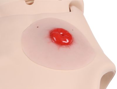 Wound moulage colostomy, self-adhesive - Erler-Zimmer PW021P, view 3