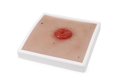 Wound Moulage Colostomy, incl. stand - Erler-Zimmer PW021, view 2