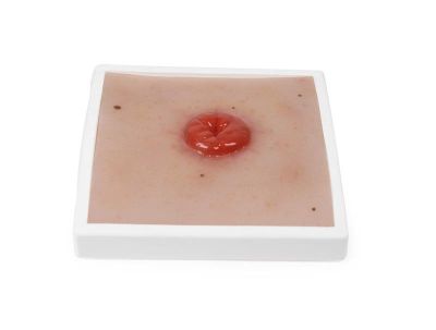 Wound Moulage Colostomy, incl. stand - Erler-Zimmer PW021