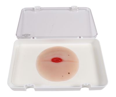 Wound moulage colostomy in abdominal fold, self-adhesive - Erler-Zimmer PW023P