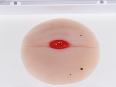 Wound moulage colostomy in abdominal fold, self-adhesive - Erler-Zimmer PW023P, view 2