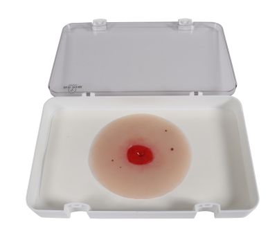 Wound moulage Colostomy below skin level, self-adhesive - Erler-Zimmer PW024P