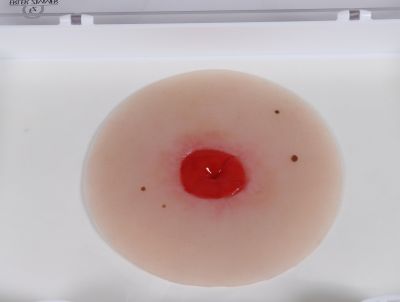 Wound moulage Colostomy below skin level, self-adhesive - Erler-Zimmer PW024P, view 2