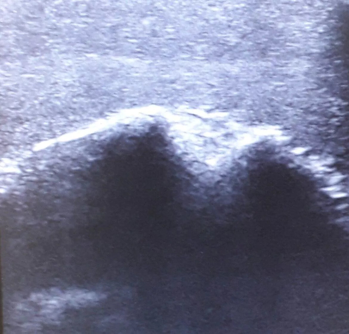 Ultrasound - Shoulder exercise model - Erler-Zimmer SEZ-SH, view 6
