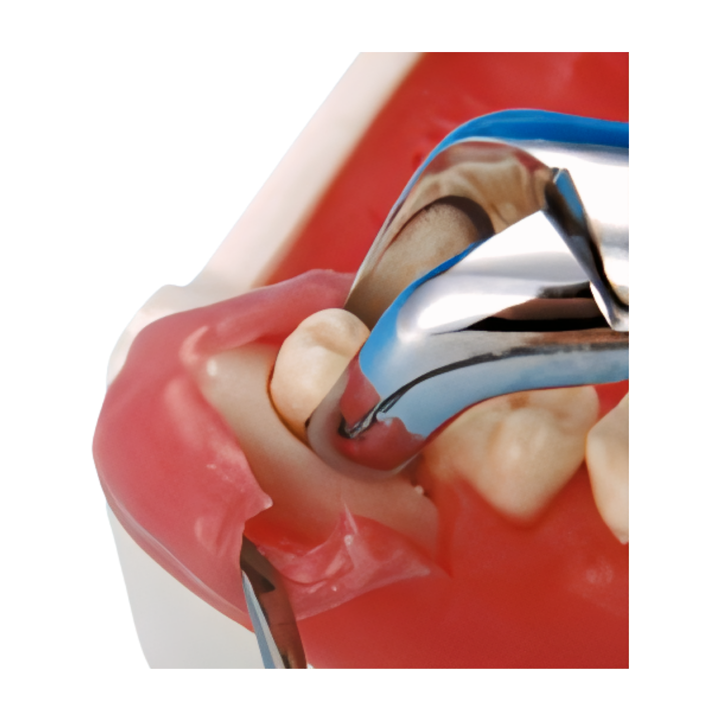 SUG1003 – Oral Surgery - Kilgore / Nissin SUG1003, view 2