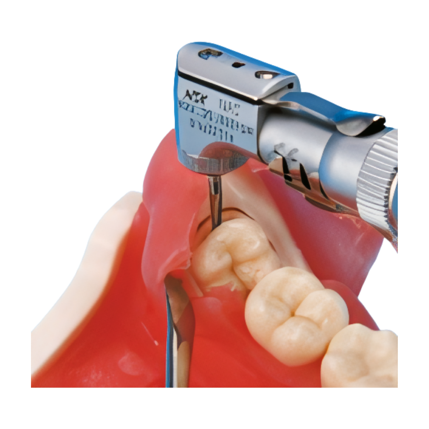 SUG1003 – Oral Surgery - Kilgore / Nissin SUG1003, view 3