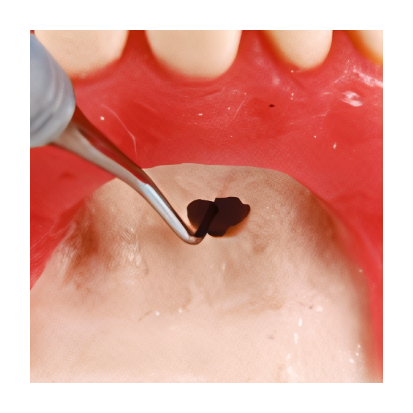 SUG1003 – Oral Surgery - Kilgore / Nissin SUG1003, view 6