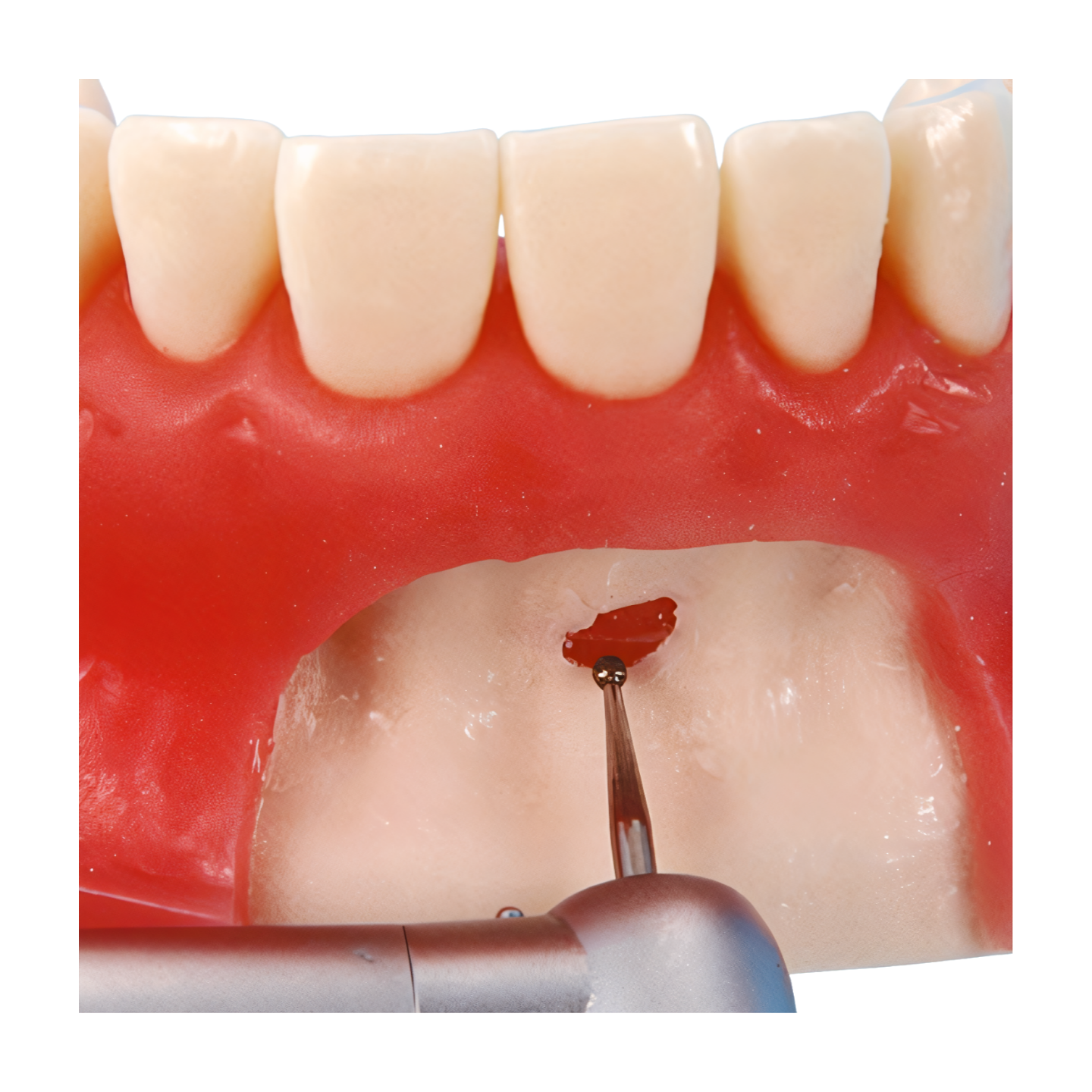 SUG1003 – Oral Surgery - Kilgore / Nissin SUG1003, view 7