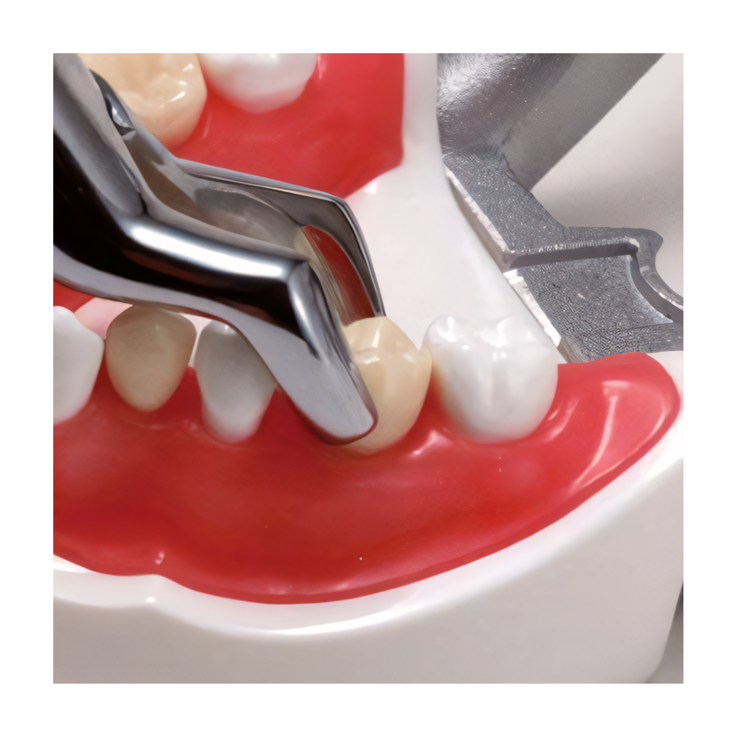 SUG2004 – Tooth Extraction - Kilgore / Nissin SUG2004, view 4
