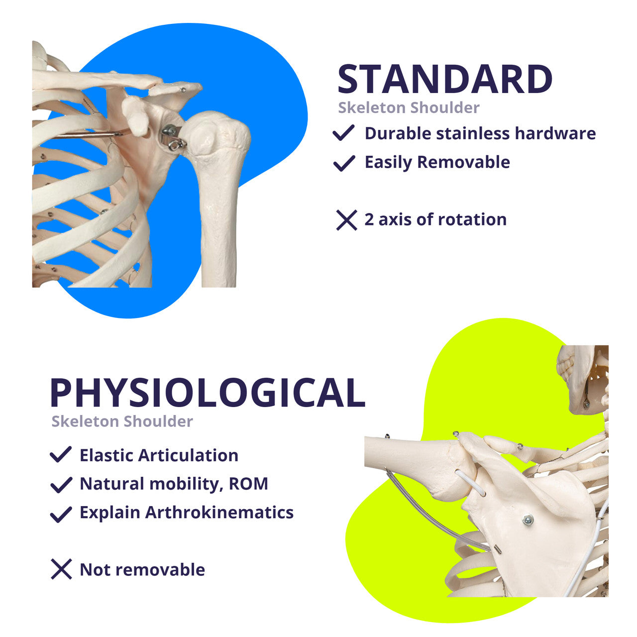 Shoulder_Joint_comparison__74832.1607998003.1280.1280.jpg