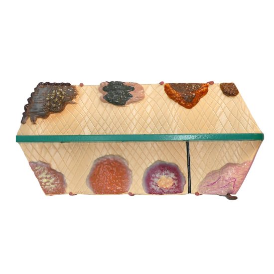 Skin Cancer Model