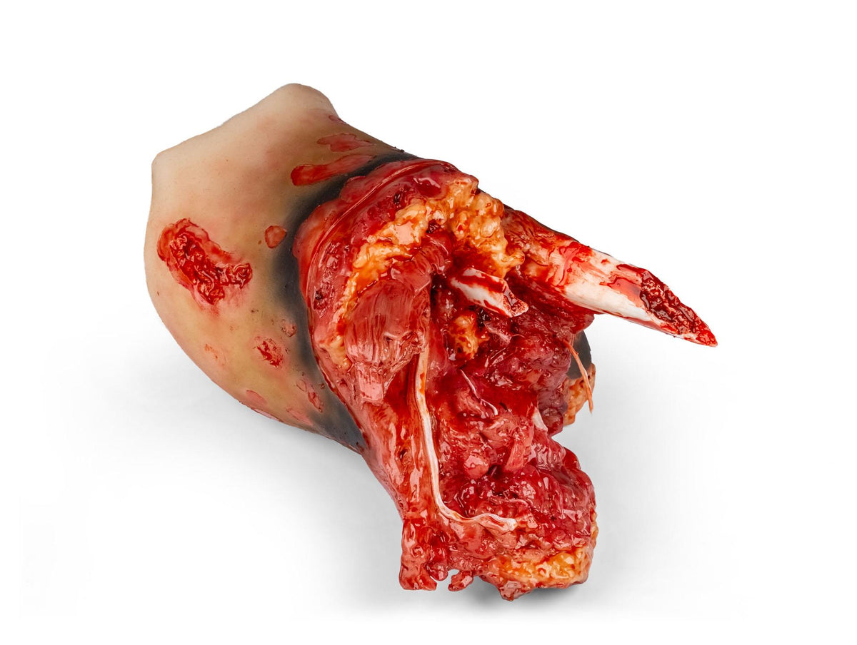 Amputation stump leg right, Combat Carl | Erler-Zimmer T3C9