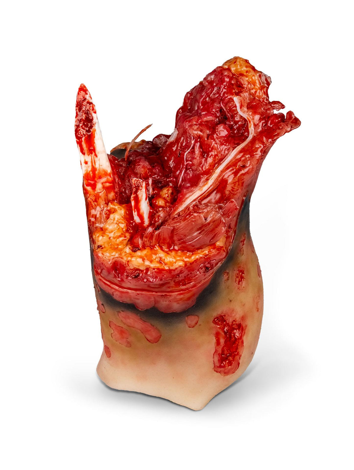 Amputation stump leg right, Combat Carl | Erler-Zimmer T3C9