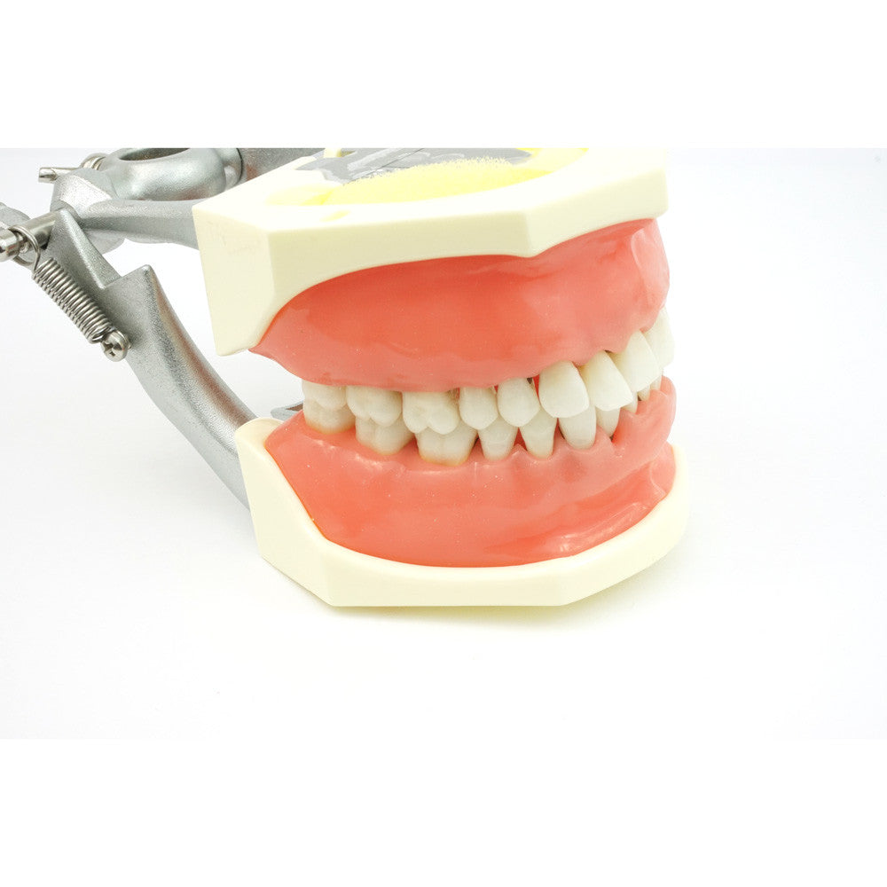 TR56C Hygiene Model with #19 edentulous and #14 super errupted
