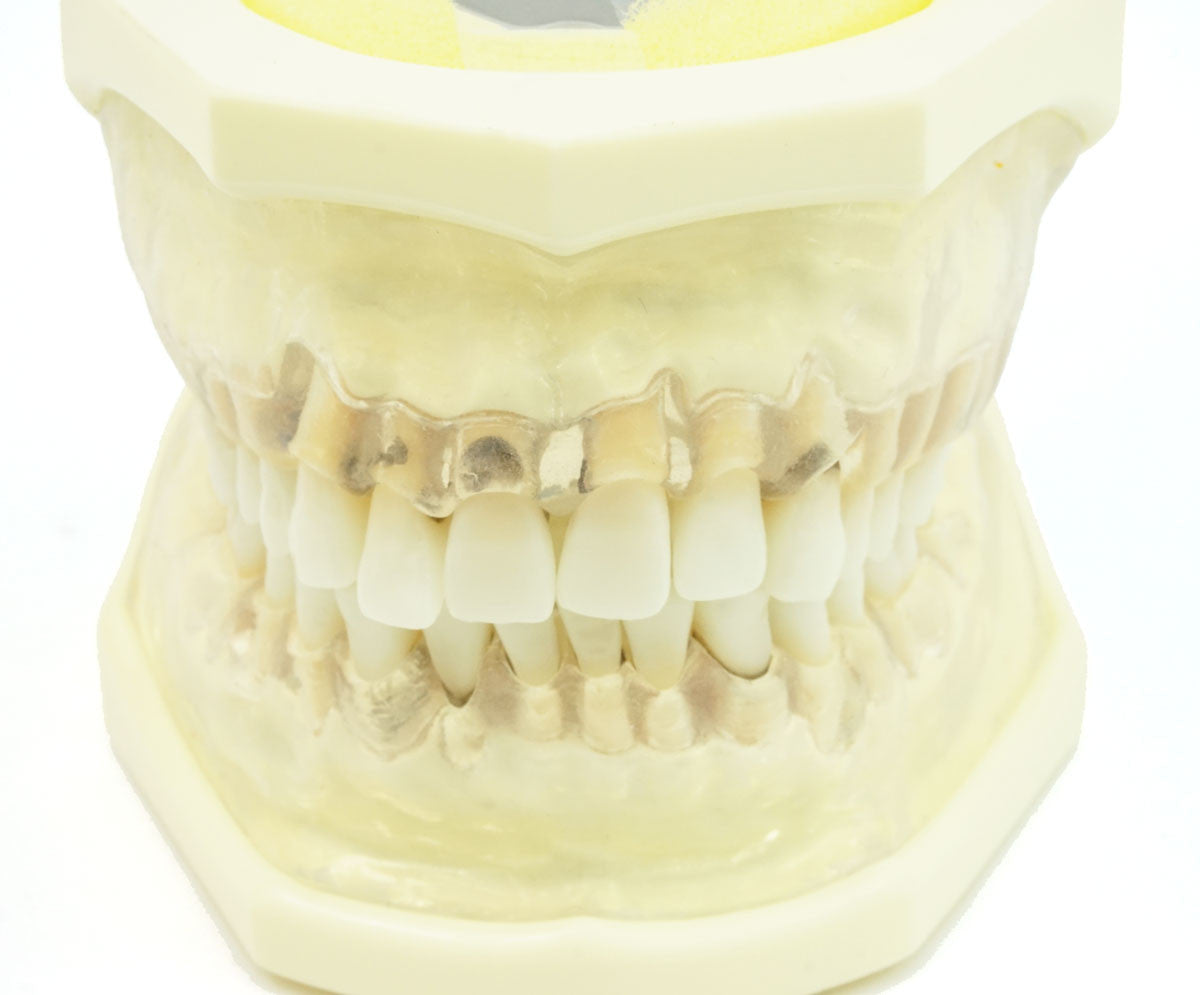 Hygiene Typodent, Full Dentition