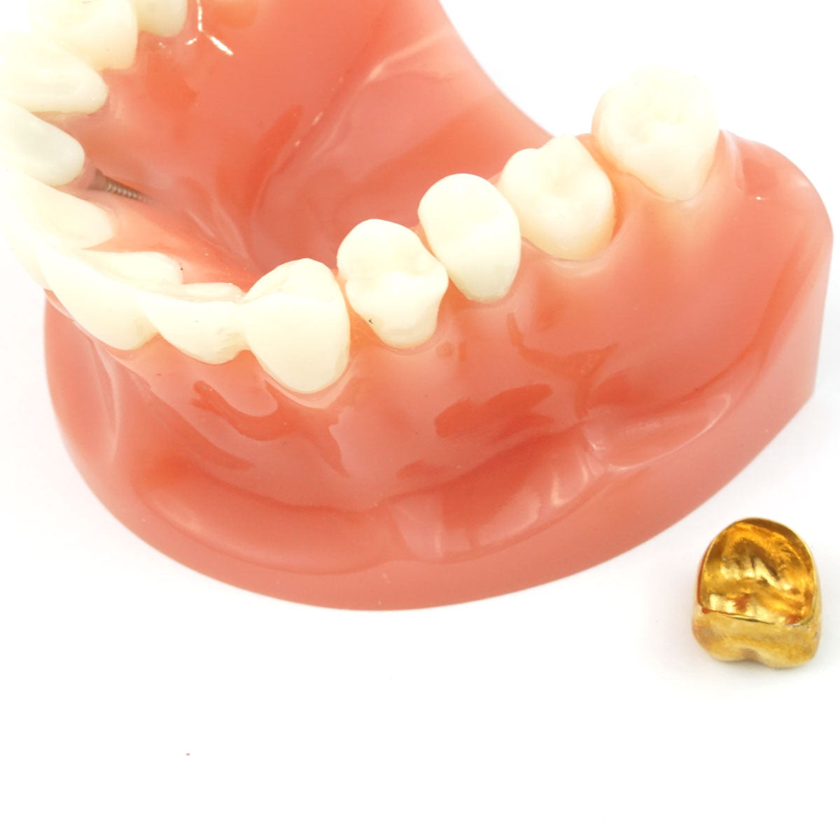 Cosmetic Crown & Bridge Model