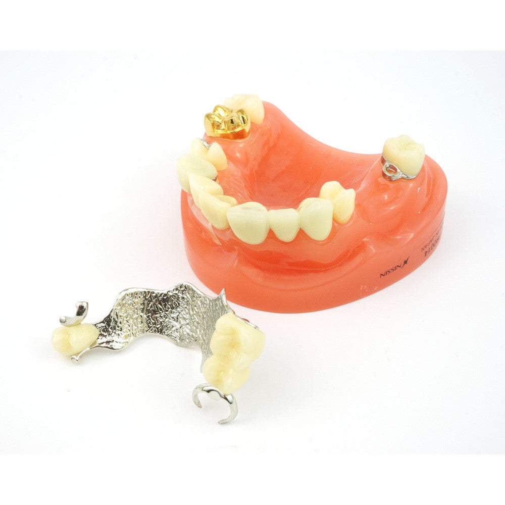 Crown & Bridge Model w/ Partial