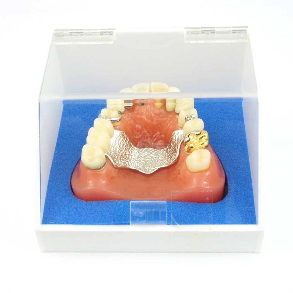 Crown & Bridge Model w/ Partial