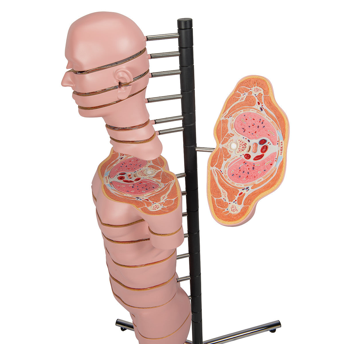 MRI Disc Torso Model with 15 Transverse Sections