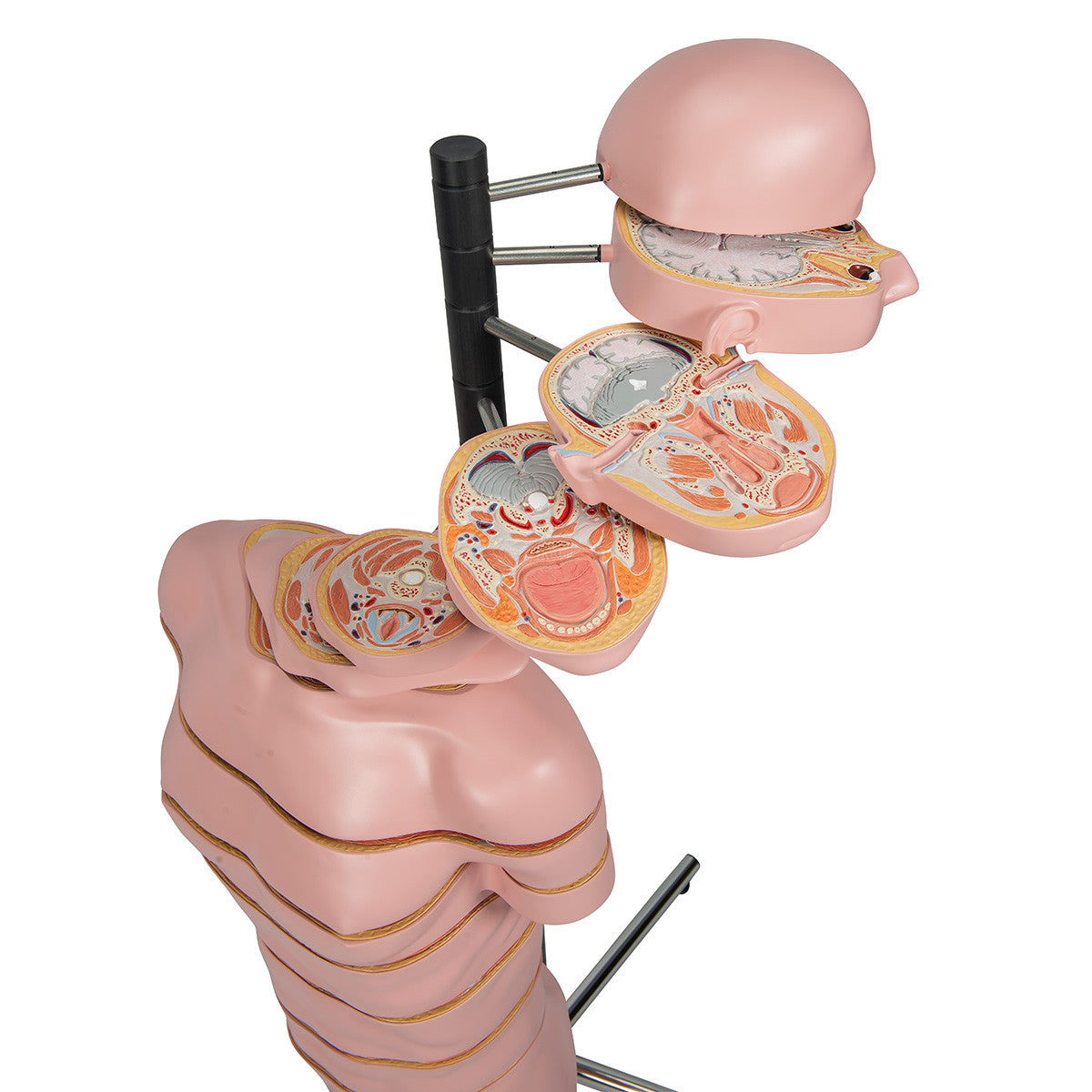 MRI Disc Torso Model with 15 Transverse Sections