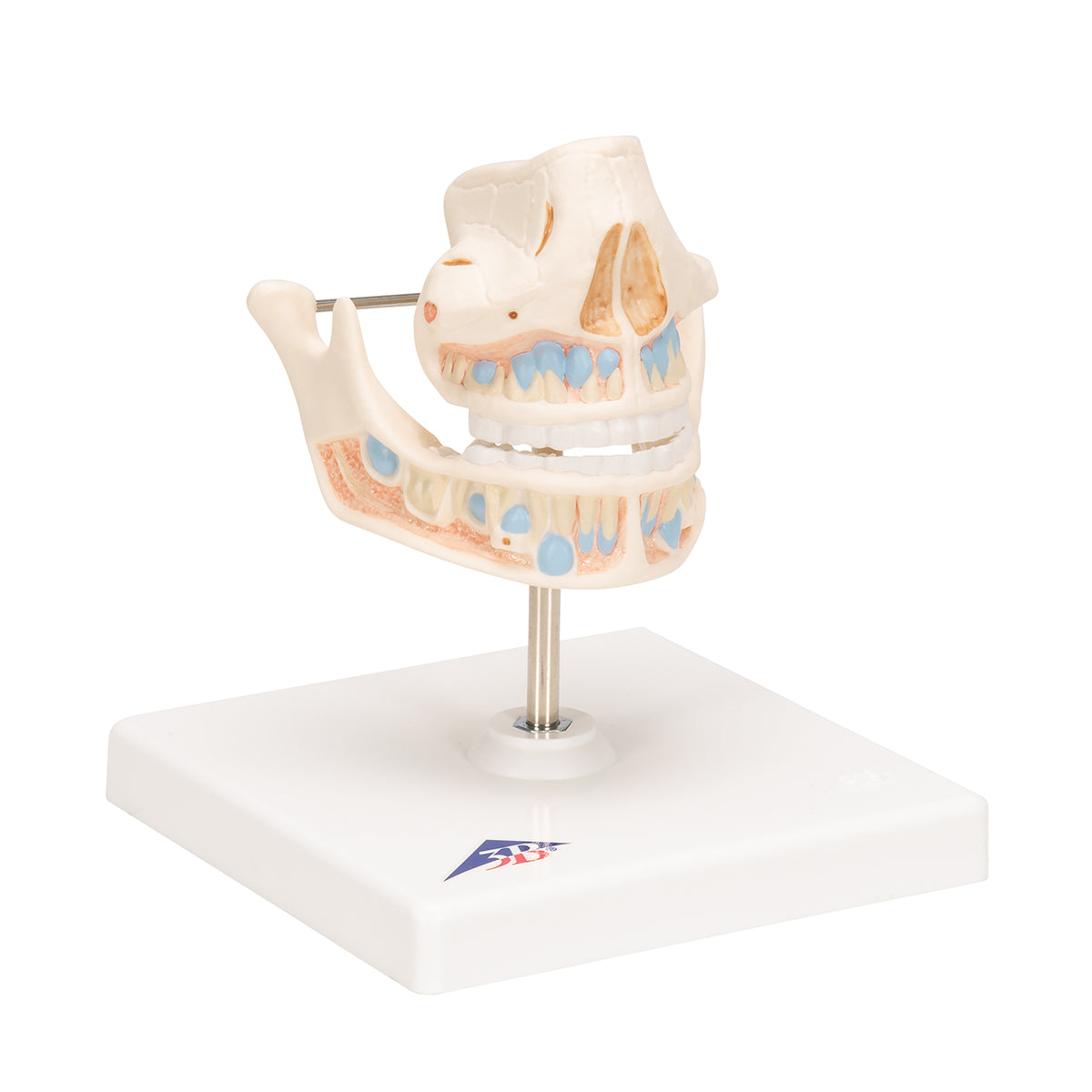 Milk Denture Model with Remaining Teeth