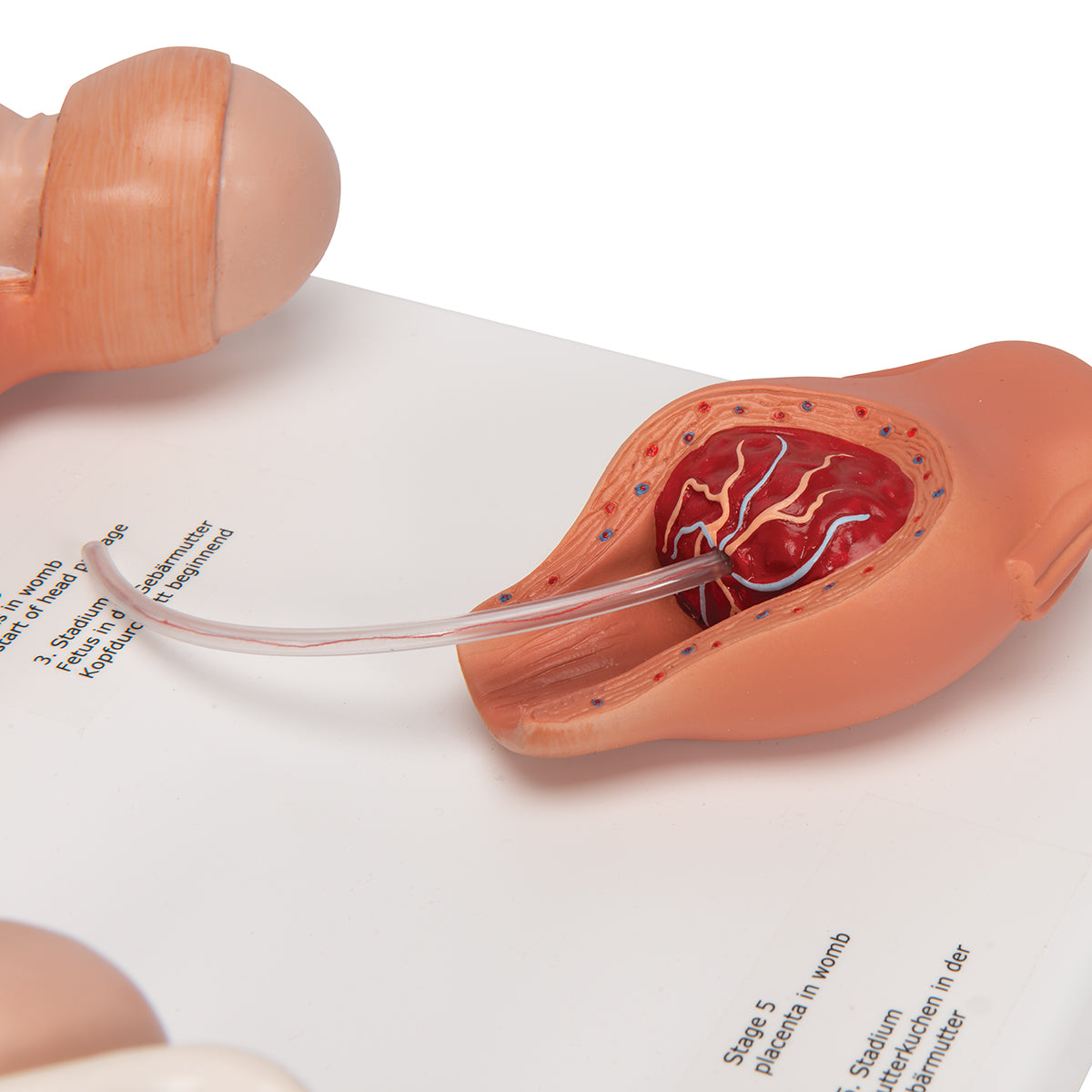 Labor Stages Model, Small