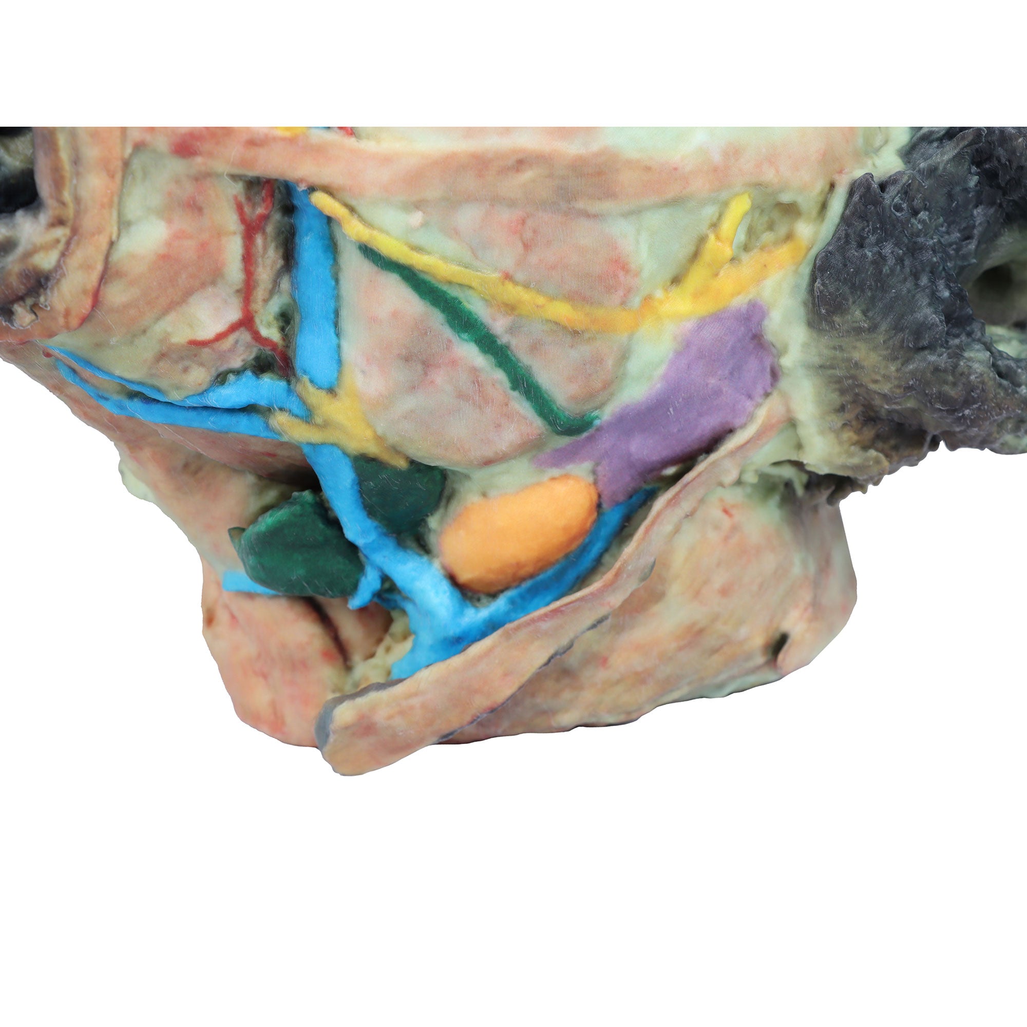 Dog head - superficial and deep dissections