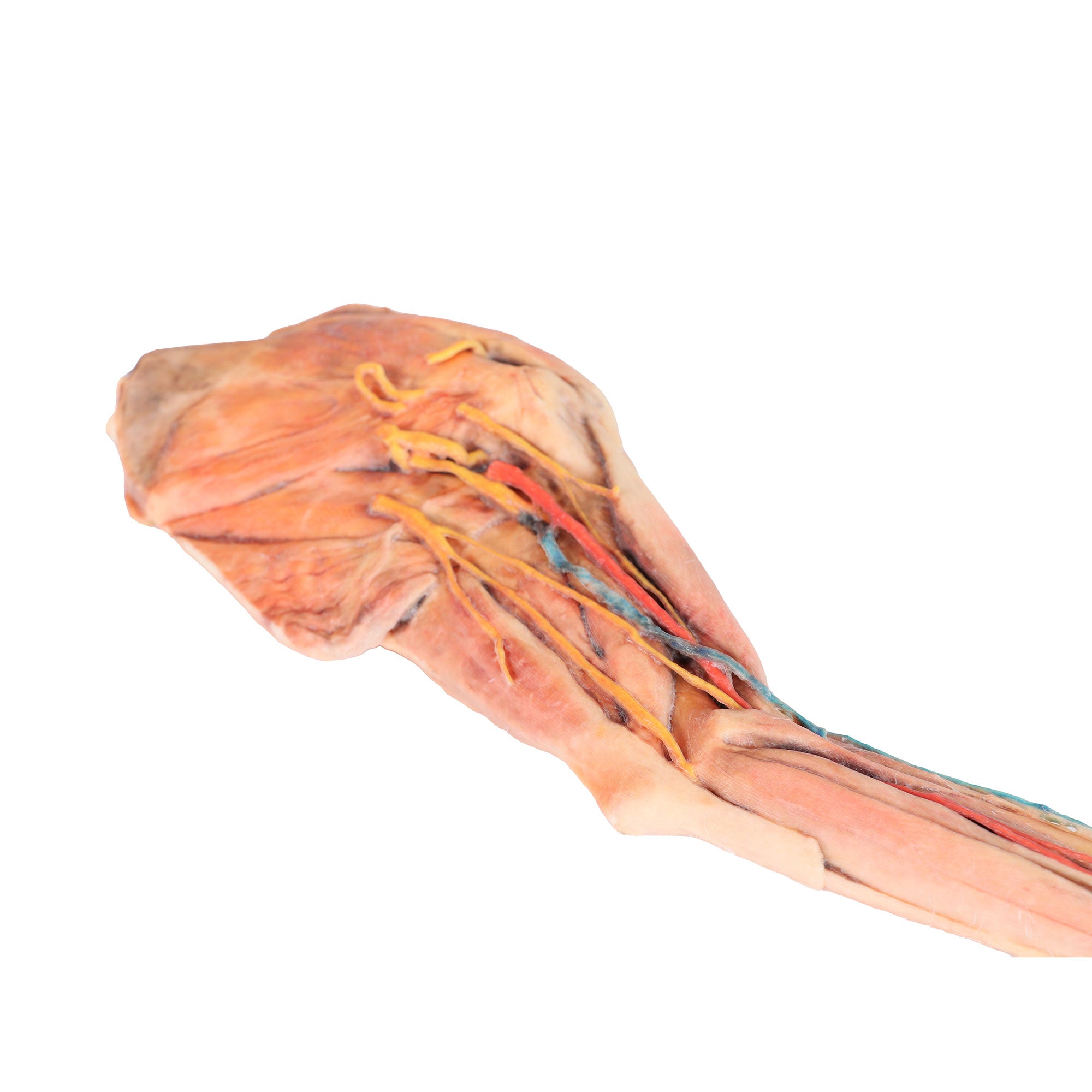 Dog forelimb - muscles, tendons, ligaments, vessels and nerves distal to the elbow