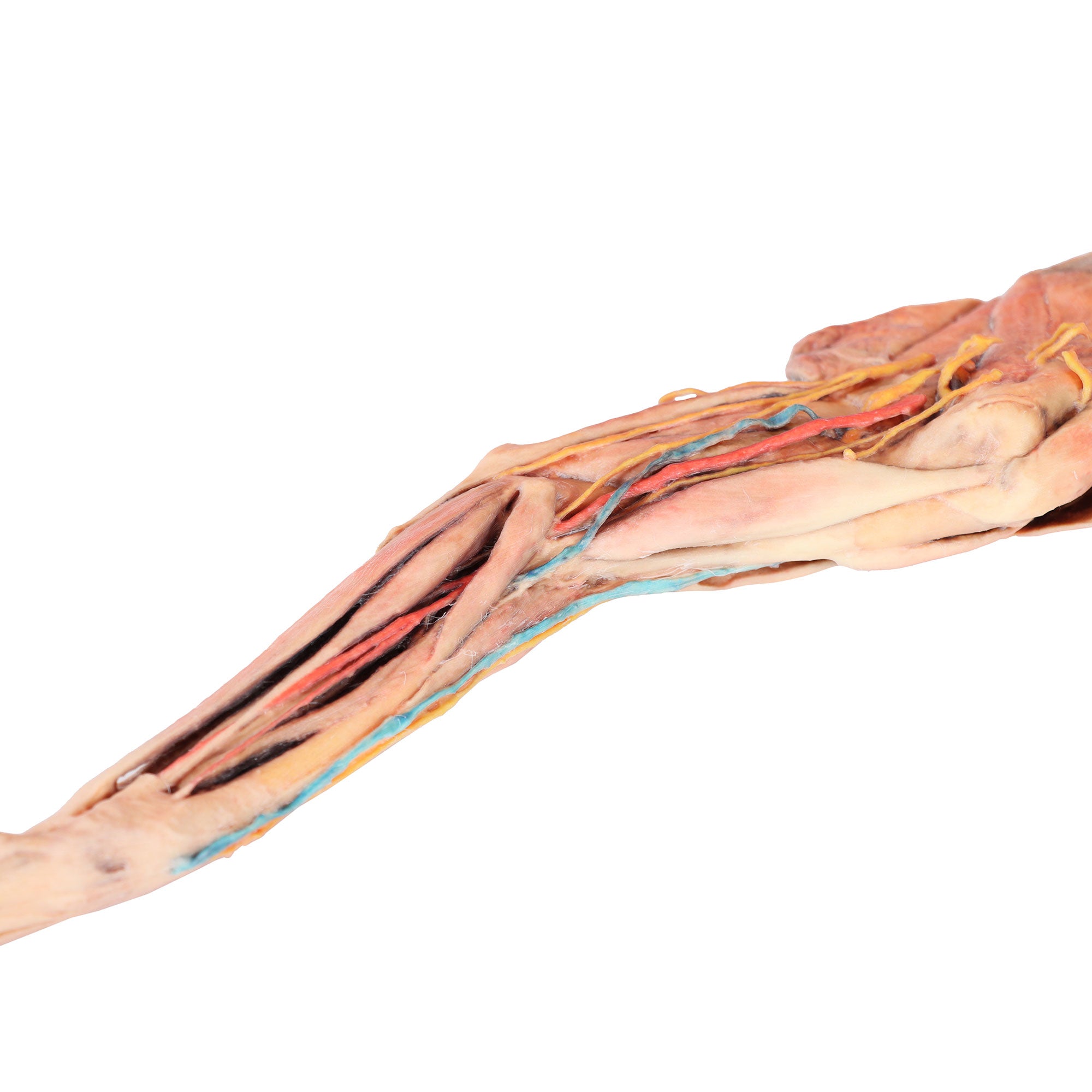 Dog forelimb - muscles, tendons, ligaments, vessels and nerves distal to the elbow