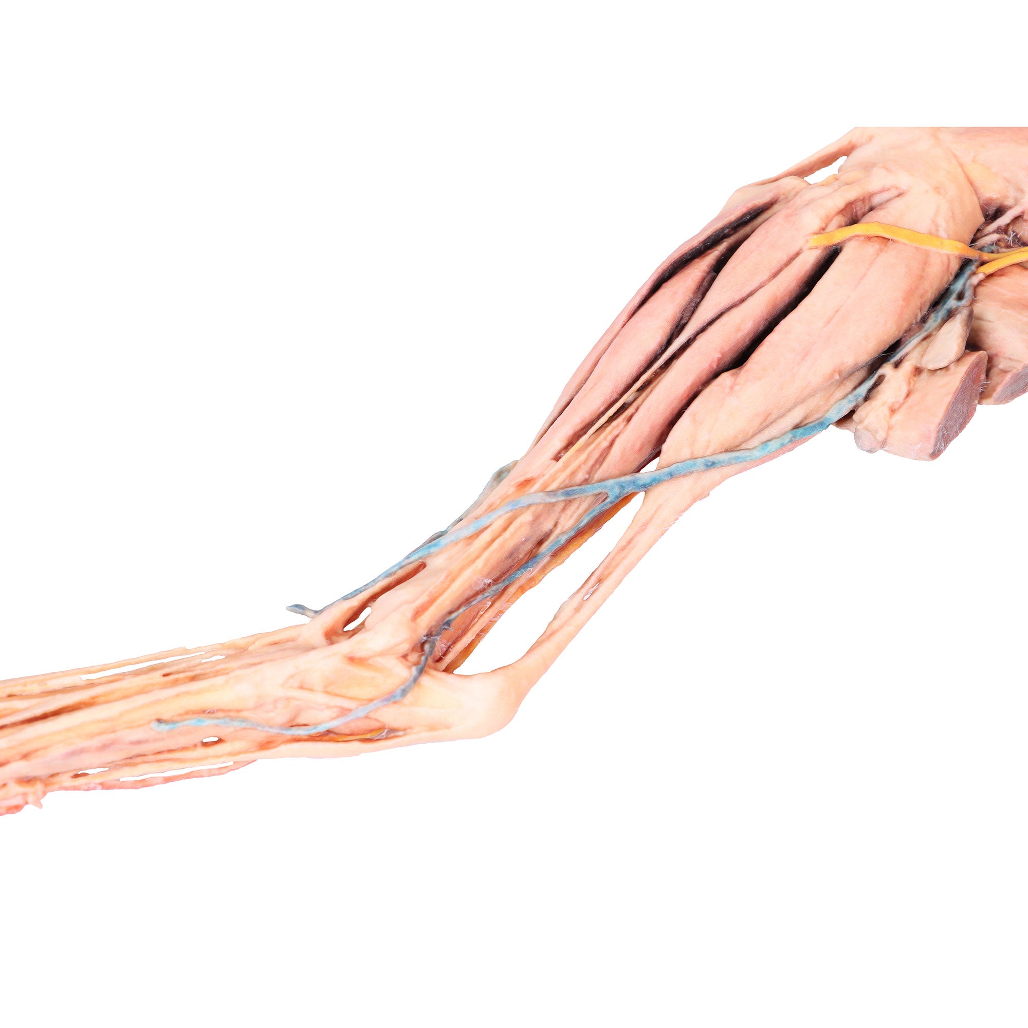 Dog hindlimb- muscles, tendons, ligaments, vessels and nerves distal to the stifle