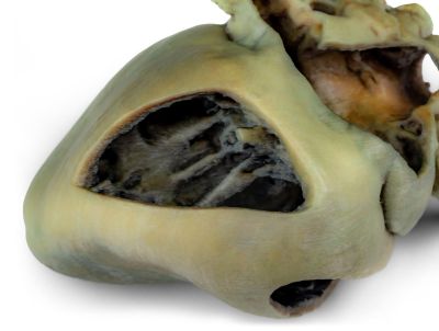 Canine heart with dissection